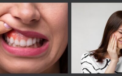 What to Do for a Toothache and Swelling Emergency: Quick Relief & When to See a Dentist