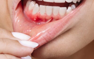 Dental Care for Swollen Gums and Jaw: What You Need to Know